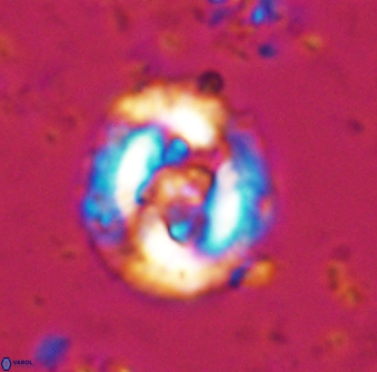 Cruciplacolithus dyoepipeda 42641