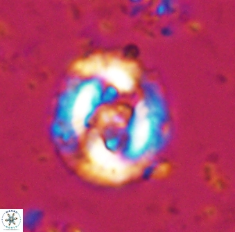 Cruciplacolithus dyoepipeda 42641