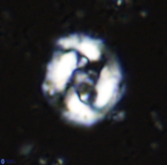 Cruciplacolithus dyoepipeda 42642