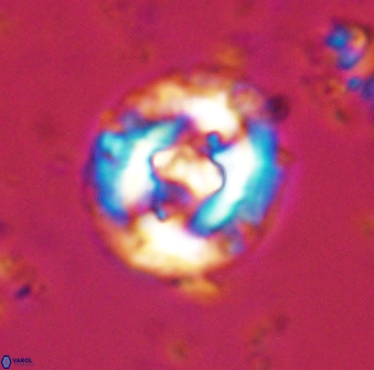 Cruciplacolithus dyoepipeda 42649