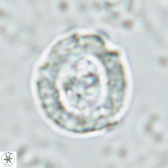 Cruciplacolithus dyoepipeda 42650