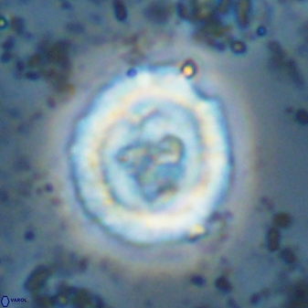 Cruciplacolithus dyoepipeda 42656