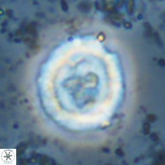 Cruciplacolithus dyoepipeda 42656