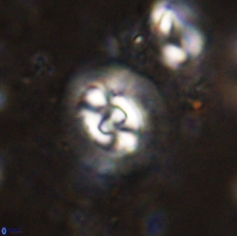 Cruciplacolithus dyoepipeda 50567