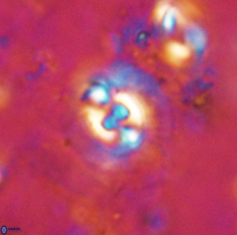 Cruciplacolithus dyoepipeda 50568