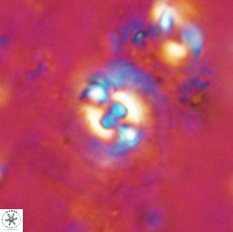 Cruciplacolithus dyoepipeda 50568
