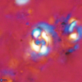 Cruciplacolithus dyoepipeda 50569