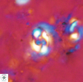 Cruciplacolithus dyoepipeda 50569