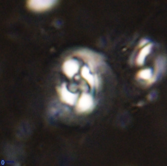 Cruciplacolithus dyoepipeda 50570