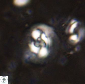 Cruciplacolithus dyoepipeda 50570