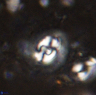 Cruciplacolithus dyoepipeda 50571