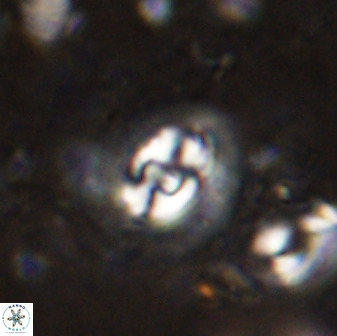 Cruciplacolithus dyoepipeda 50571