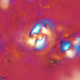 Cruciplacolithus dyoepipeda 50573