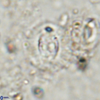 Cruciplacolithus dyoepipeda 50574