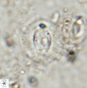 Cruciplacolithus dyoepipeda 50574