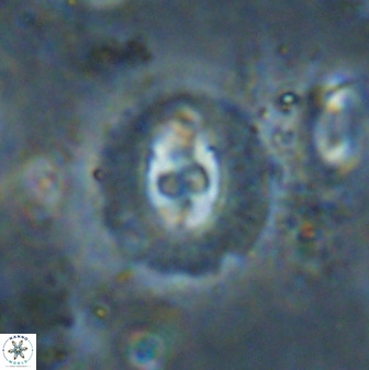 Cruciplacolithus dyoepipeda 50575