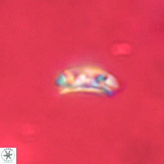 Cruciplacolithus dyoepipeda VR 00402