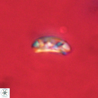 Cruciplacolithus dyoepipeda VR 00406