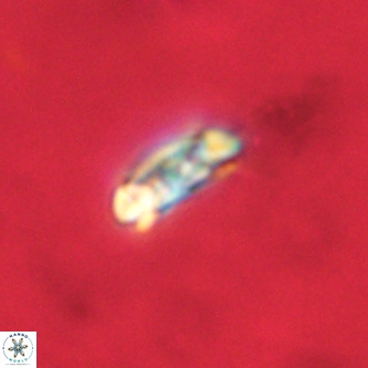 Cruciplacolithus dyoepipeda VR 00412