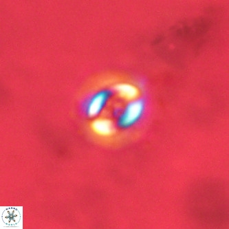 Cruciplacolithus dyoepipeda VR 00435