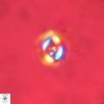 Cruciplacolithus dyoepipeda VR 00436