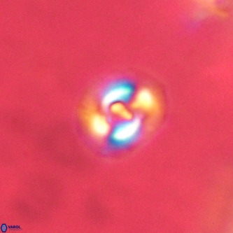 Cruciplacolithus dyoepipeda VR 01374