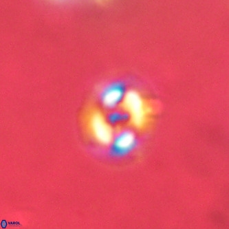 Cruciplacolithus dyoepipeda VR 01375