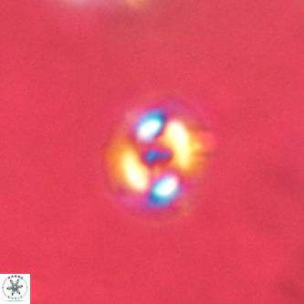 Cruciplacolithus dyoepipeda VR 01375