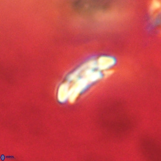 Cruciplacolithus dyoepipeda VR 01380