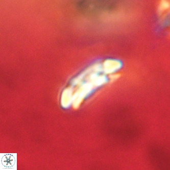 Cruciplacolithus dyoepipeda VR 01380