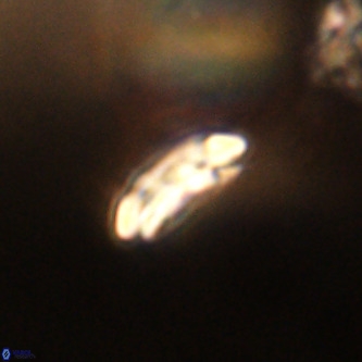 Cruciplacolithus dyoepipeda VR 01381