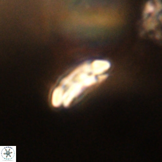 Cruciplacolithus dyoepipeda VR 01381