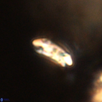 Cruciplacolithus dyoepipeda VR 01382