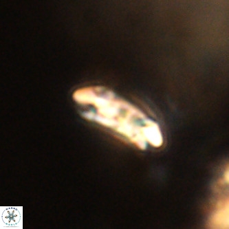 Cruciplacolithus dyoepipeda VR 01382