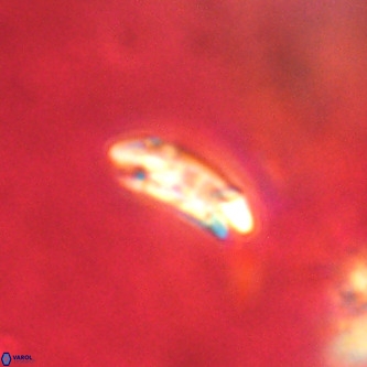 Cruciplacolithus dyoepipeda VR 01383