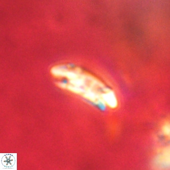 Cruciplacolithus dyoepipeda VR 01383