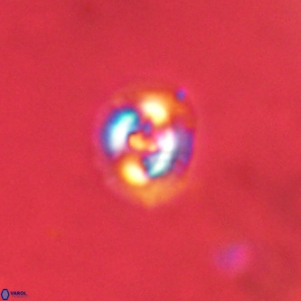 Cruciplacolithus dyoepipeda VR 01391