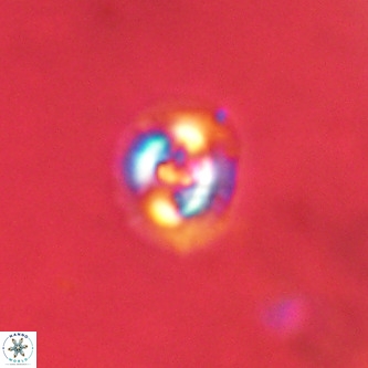 Cruciplacolithus dyoepipeda VR 01391