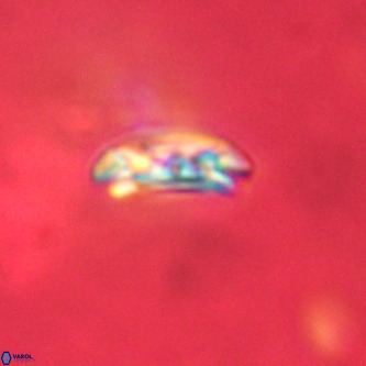 Cruciplacolithus dyoepipeda VR 01394