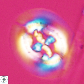 Cruciplacolithus frequens 24592