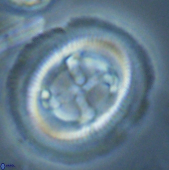 Cruciplacolithus frequens 25164