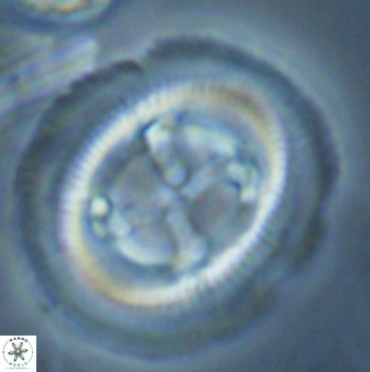Cruciplacolithus frequens 25164