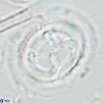 Cruciplacolithus frequens 25165