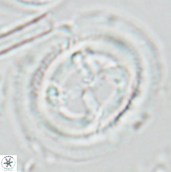 Cruciplacolithus frequens 25165