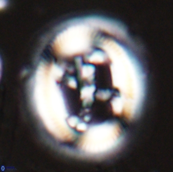 Cruciplacolithus frequens 25160