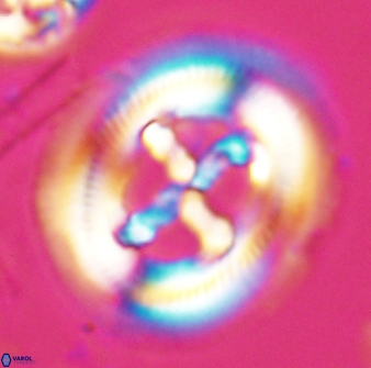 Cruciplacolithus frequens 25162