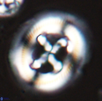 Cruciplacolithus frequens 25163