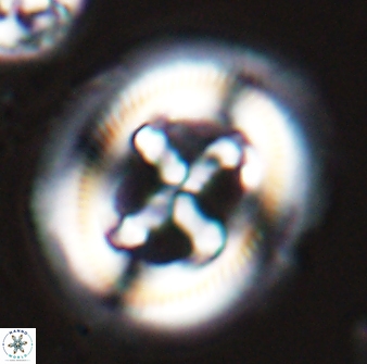 Cruciplacolithus frequens 25163