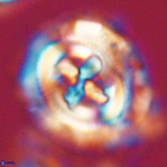 Cruciplacolithus frequens 21175