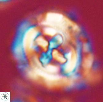 Cruciplacolithus frequens 21175
